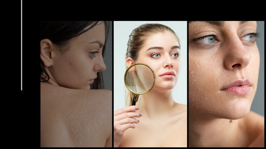 Is your skin dry or dehydrated, oily or less oily? What causes what? Feeling confused?